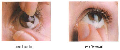 Contact Lens Insertion and Removal